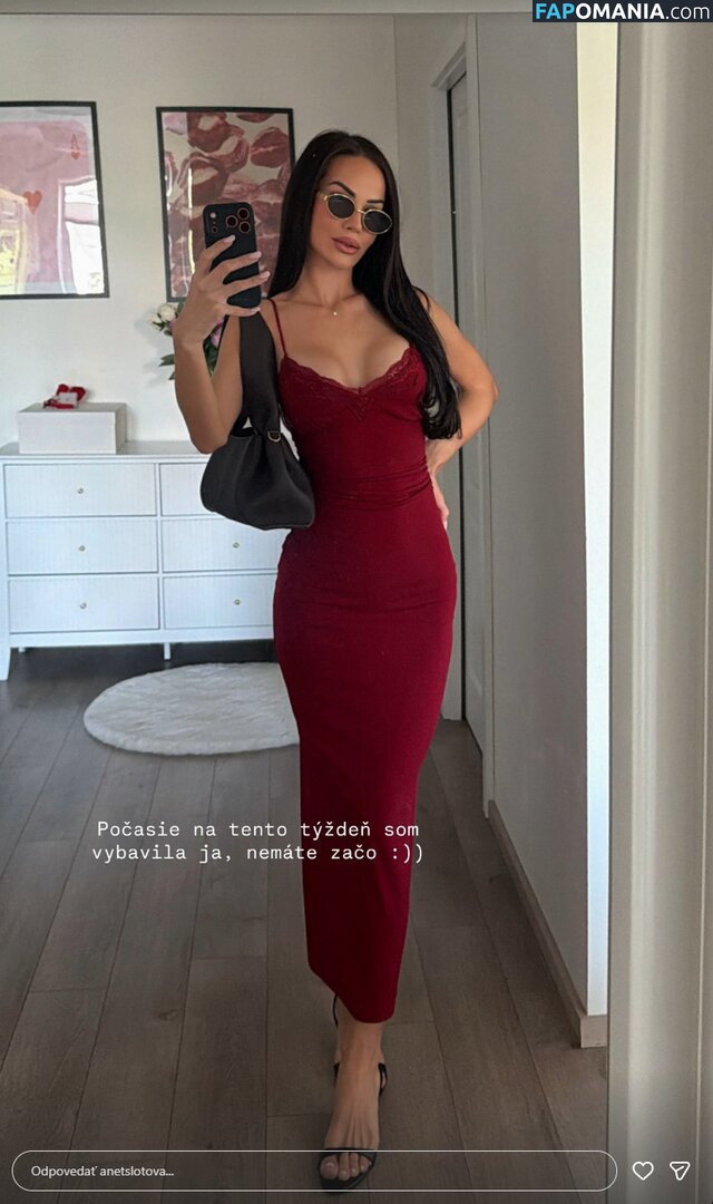 Anet Slotova / anetslotova Çıplak OnlyFans  Sızdırılmış Fotoğraf #1