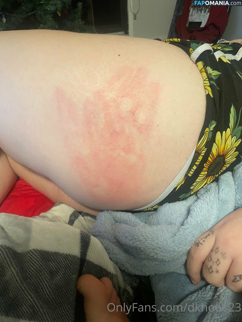 dk12345678947 / dkhoe123 Çıplak OnlyFans  Sızdırılmış Fotoğraf #7